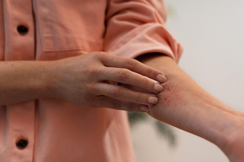 Sorocaba Vacinas: Segurança e cuidado de quem você confia para prevenção de Herpes Zóster