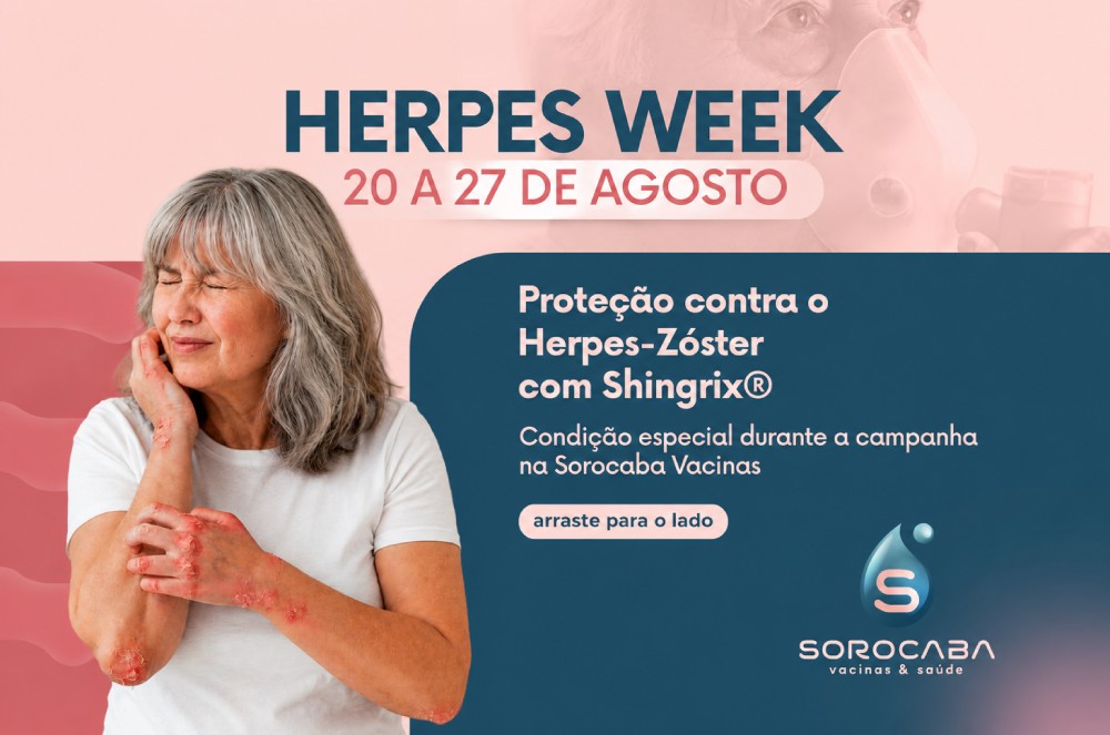 Sorocaba Vacinas realiza Herpes Week de 20 a 27 de agosto com condições especiais para vacinação contra Herpes-Zóster